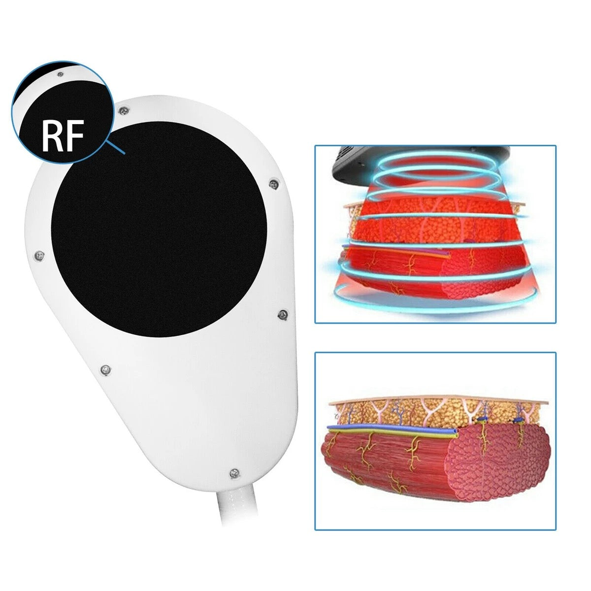Accessory Handle For Mini EMSlim Neo Machine